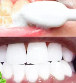 Tooth Whitening Mousse (Large)
